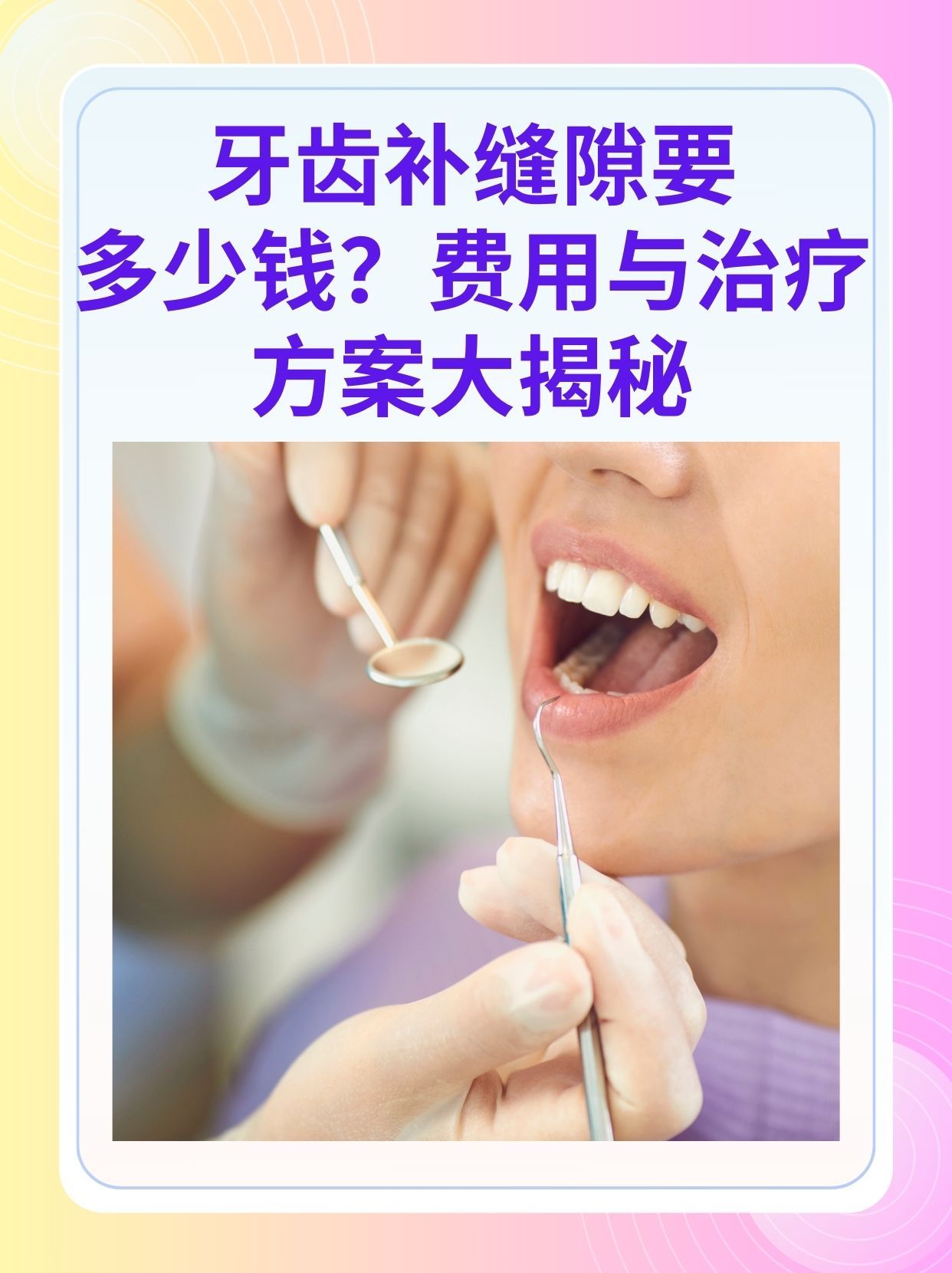 黄石补牙医保可以报销吗(补牙医保可以报销吗 哪些可以报销呢)